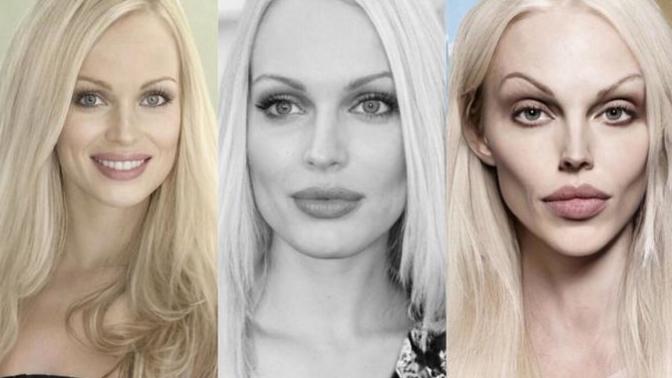 Which plastic surgeries and procedures do you think she had? And do you like the results?