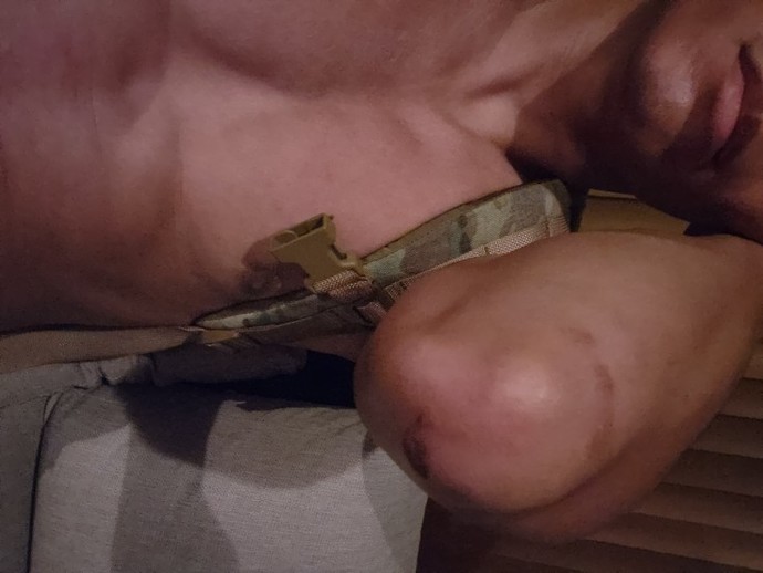 Do you have cute elbows?