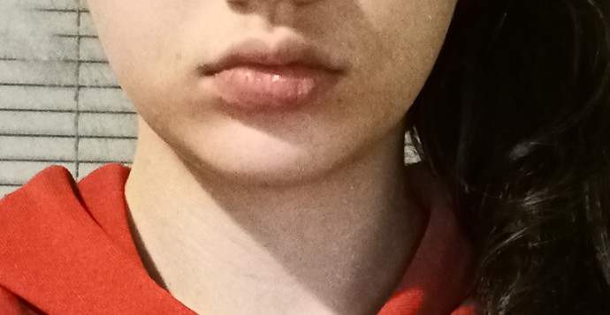 Would braces be able to fix my lower jaw?