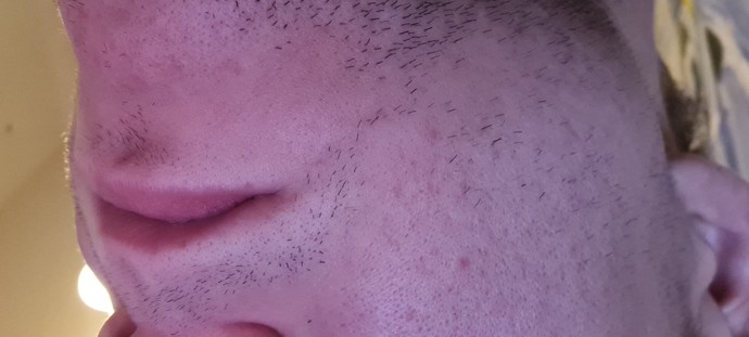Skincare help, how to remove pores?