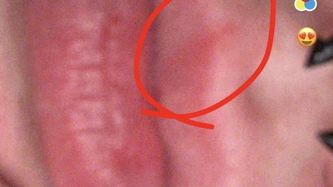 Is this a cold sore or just a cut?