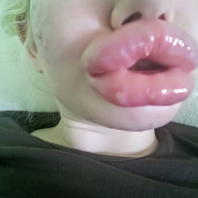 Guys, Do men find Thick Lips beautiful and attractive?