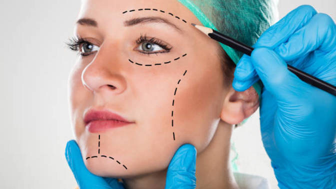 Would you consider getting plastic surgery?