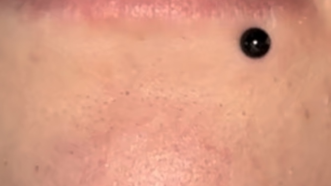 Cold sore itch URGENT HELP?
