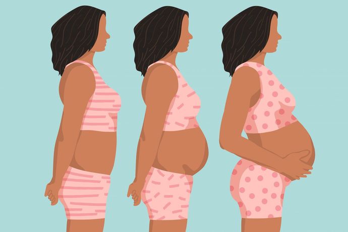 Why is it that the leading cause of death in pregnant women living in the US is homicide?