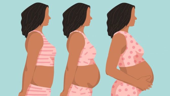 Why is it that the leading cause of death in pregnant women living in the US is homicide?