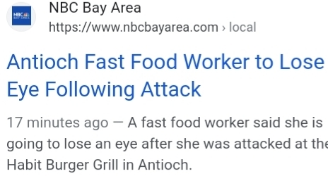 Burger worker loses eye?