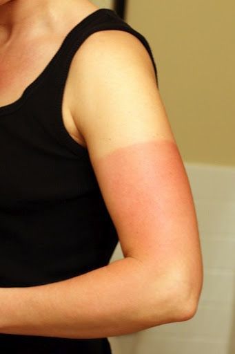 Farmer's Tan