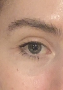 What sale is my eye?