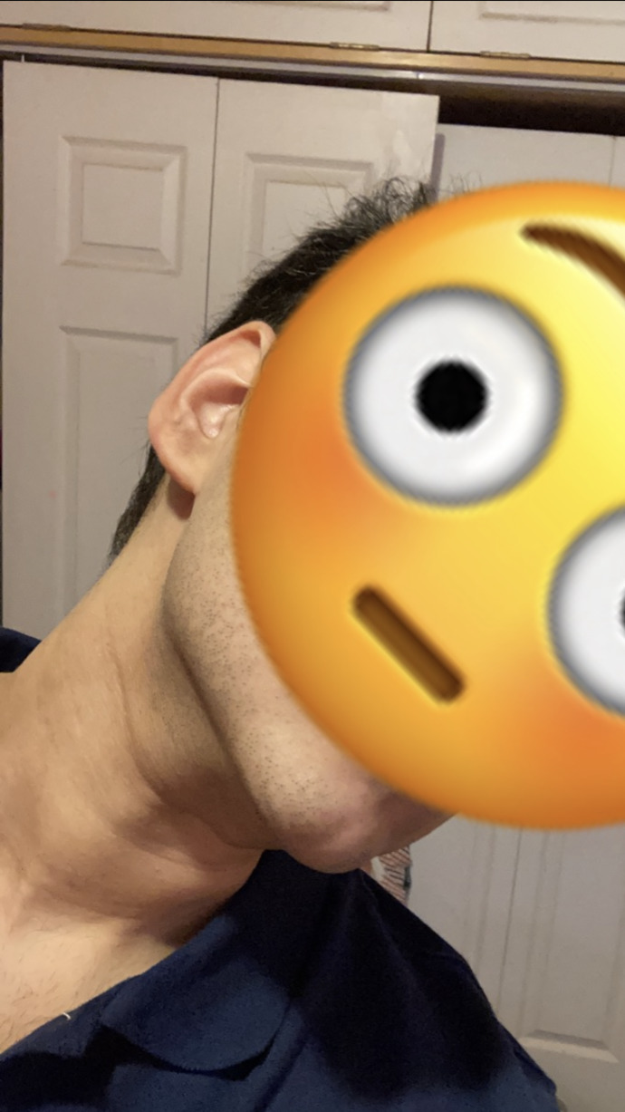How can I lose the water retention in my face?