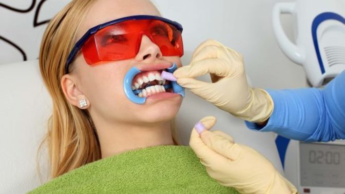 I always see that americans have super white teeth. How common is the usage of whitening strips in america?