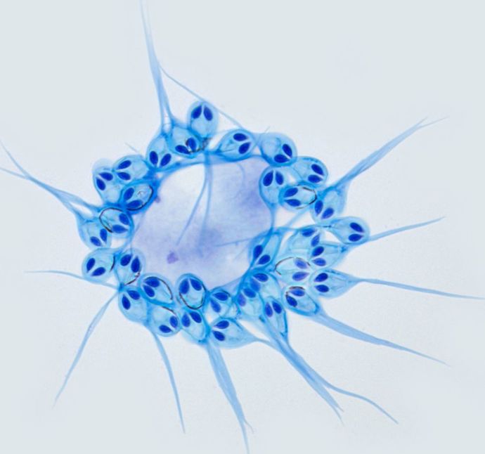 parasite H. salminicola