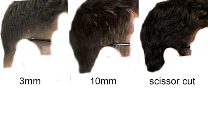 Most attractive hair length on sides?