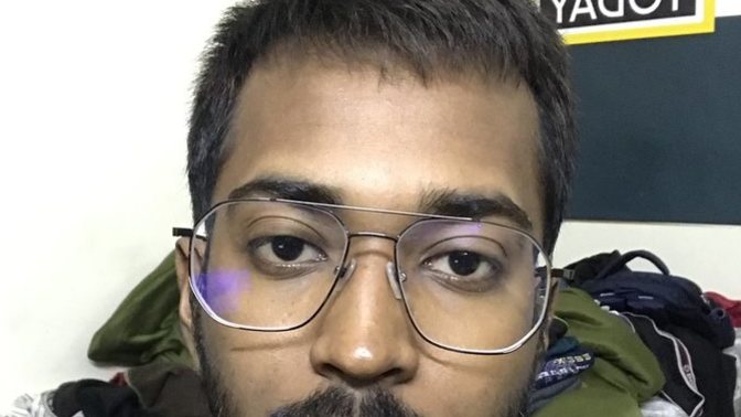 What is my face shape? what kind of hair style would look good on me? considering I have a little less hair on my sides? refer the picture?