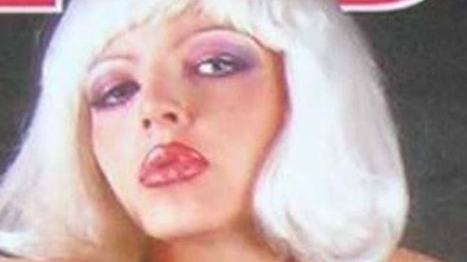 Do you think this vintage singer had lip fillers / plastic surgery when this picture was taken?
