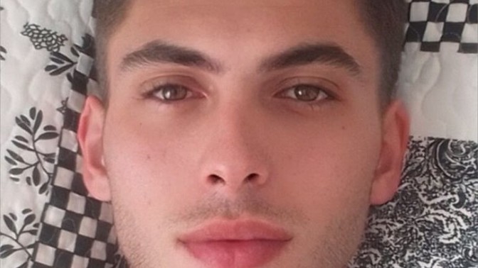 Do I get plastic surgery on my face?