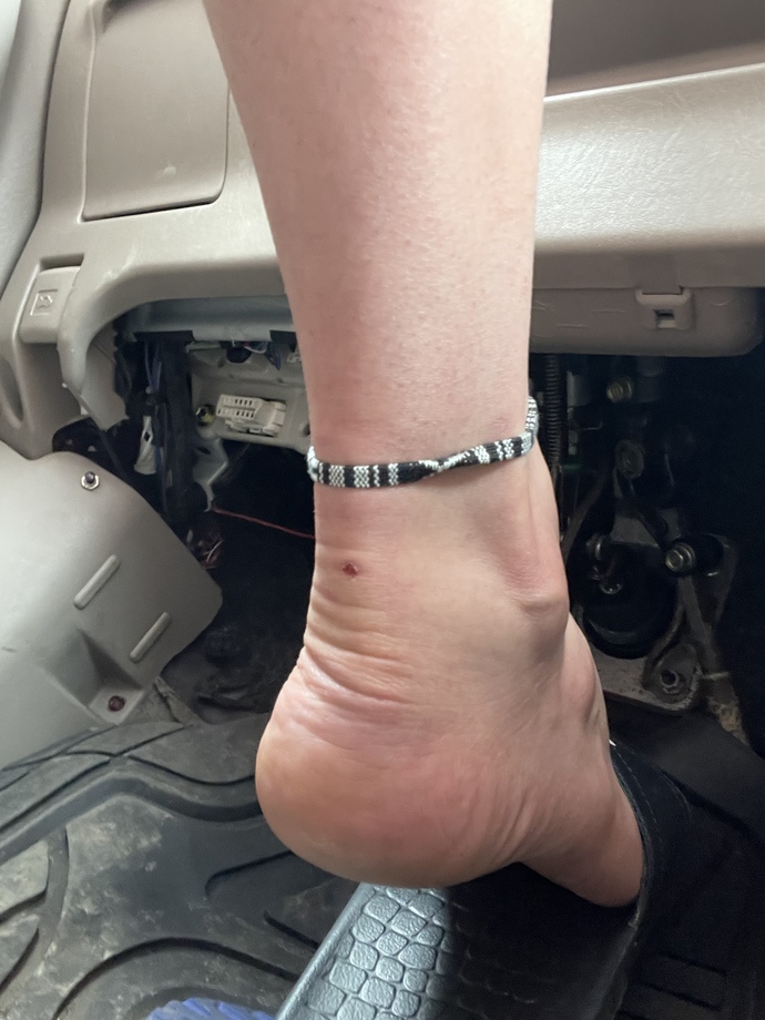 Ladies, what do you think of men who wear anklets (ankle bracelets)?