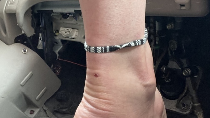 Ladies, what do you think of men who wear anklets (ankle bracelets)?