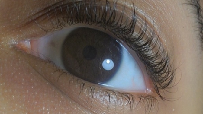 Distichiasis or just a load of eyelashes? Also what's the hype about women wanting long and full eyelashes?