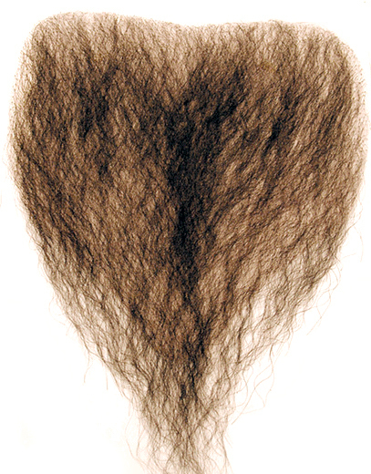Is there any way at all to reverse laser hair removal?