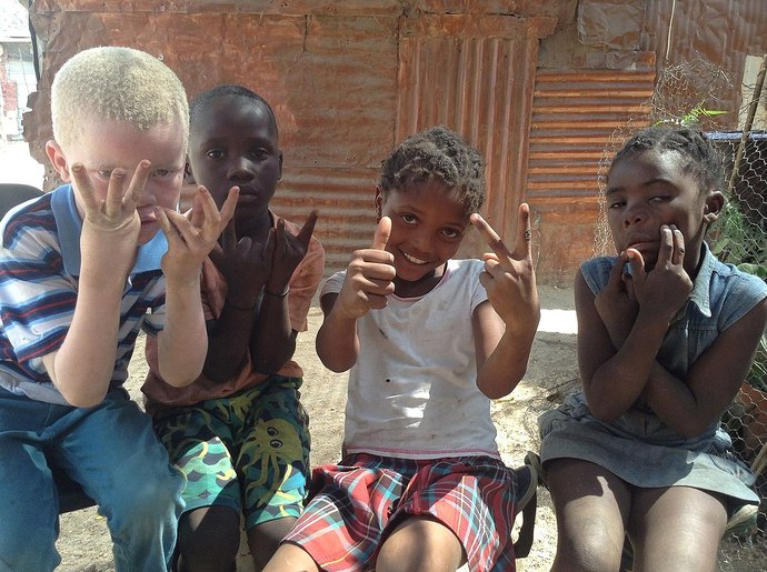 Albino boy with black friends. Can't we all just get along?