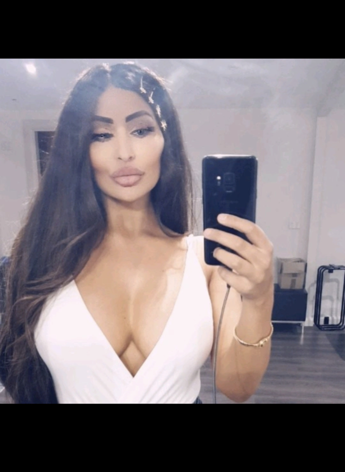 Do you think she is BEAUTIFUL (putting aside the fact she has had plastic surgery)?