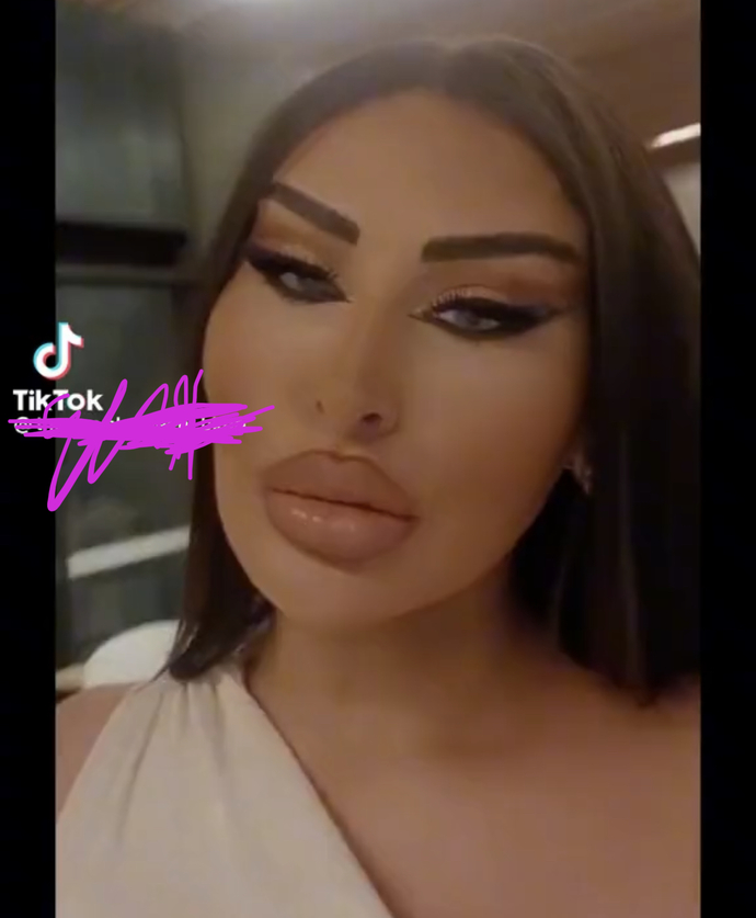 Do you think she is BEAUTIFUL (putting aside the fact she has had plastic surgery)?