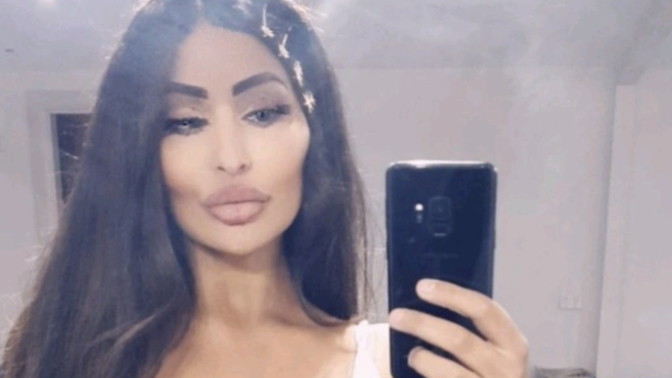 Do you think she is BEAUTIFUL (putting aside the fact she has had plastic surgery)?