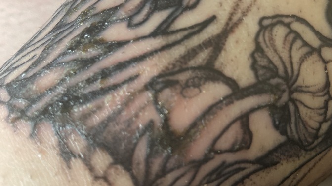 What to do for my tattoo?