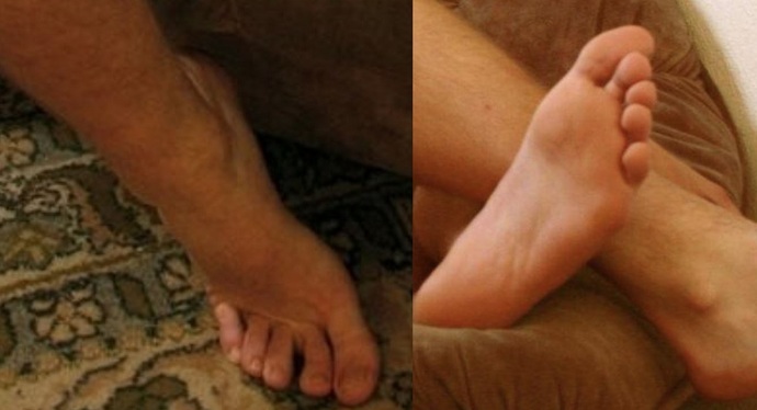 Are my boyfriends feet ugly, average or cute in your opinion?