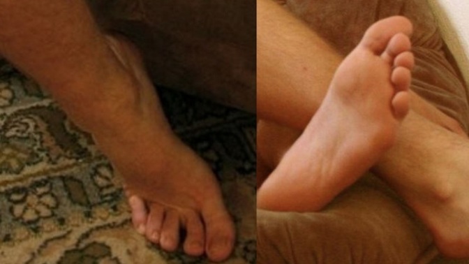 Are my boyfriend's feet ugly, average or cute in your opinion?