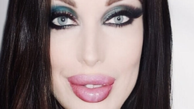 What plastic surgeries and procedures do you think she had?