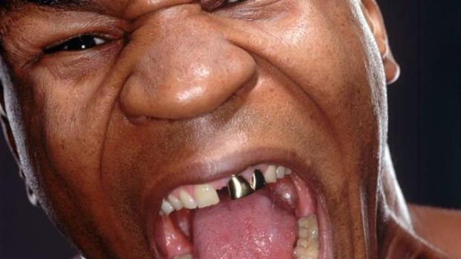 Can you wear a single tooth cap on your front tooth for an amateur boxing match with a mouthpiece protection?