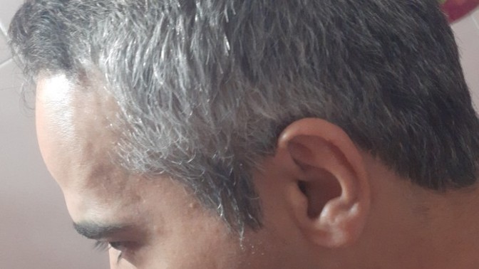 What do girls and women think about men with white or gray hair between 40 and 50 years old? Are they attractive? Should they dye their hair?