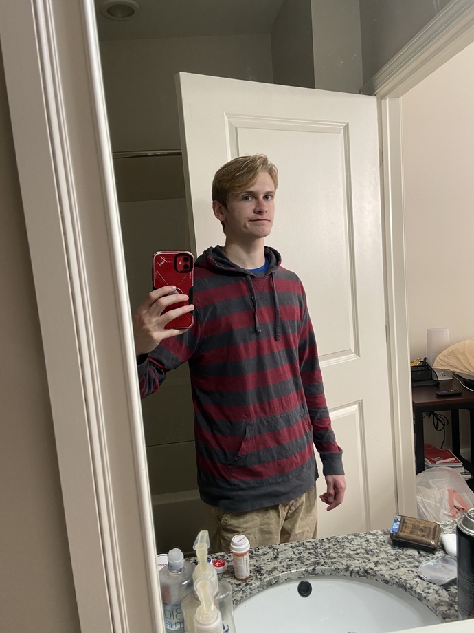 Girls, 20M am I attractive? I’ve never had a girlfriend and am insecure about chest shape. I lack social skills and confidence. What do girls think?