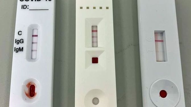 Have YOU tested positive for covid yet at all?