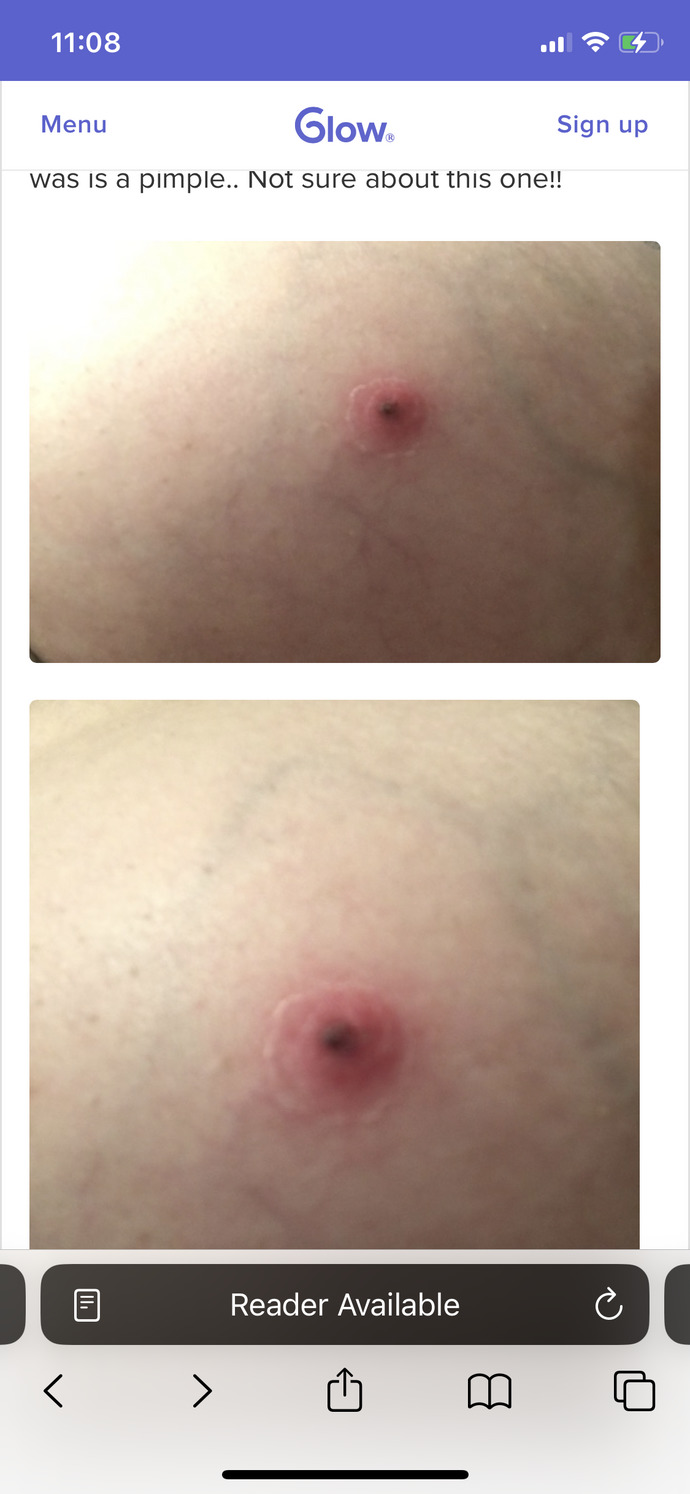 Ladies can you tell me if I should be worried about my breast and get it examined?