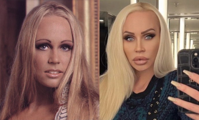 Does she look more beautiful before or after the cosmetic procedures?