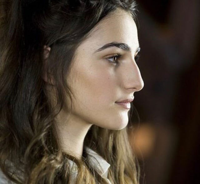 Which nose type do you like more?