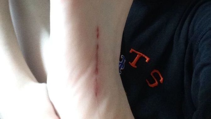 Cut my foot on loose nail, should I be worried or not?