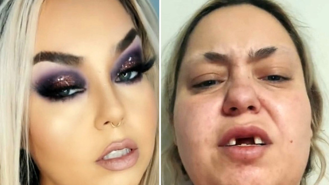 When a woman wears a bunch of makeup and implants is that a form of catfishing?