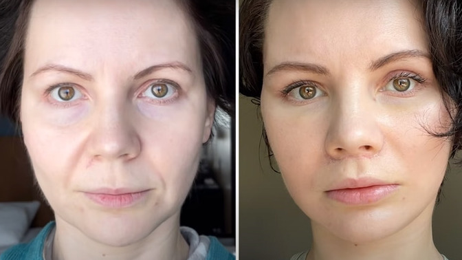 How young does this 41 year old woman look after plastic surgery?