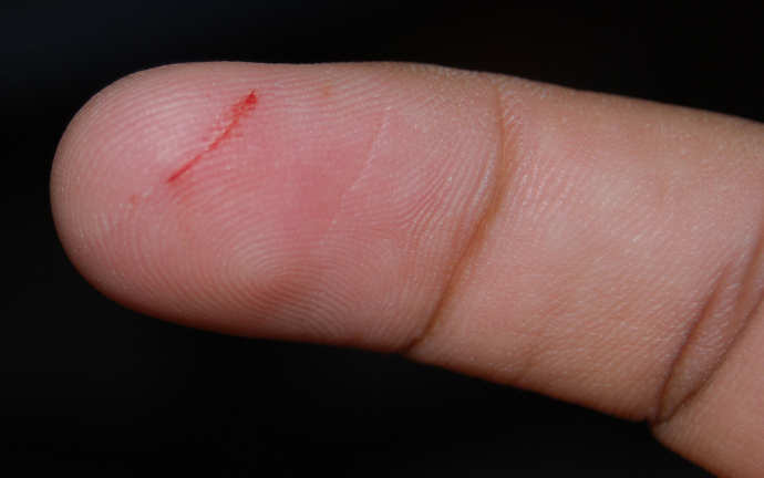 Do you enjoy getting paper cuts?