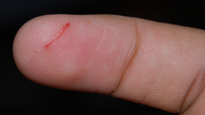 Do you enjoy getting paper cuts?