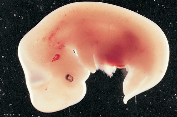 Where do some women get the notion that killing babies is a woman’s right?
