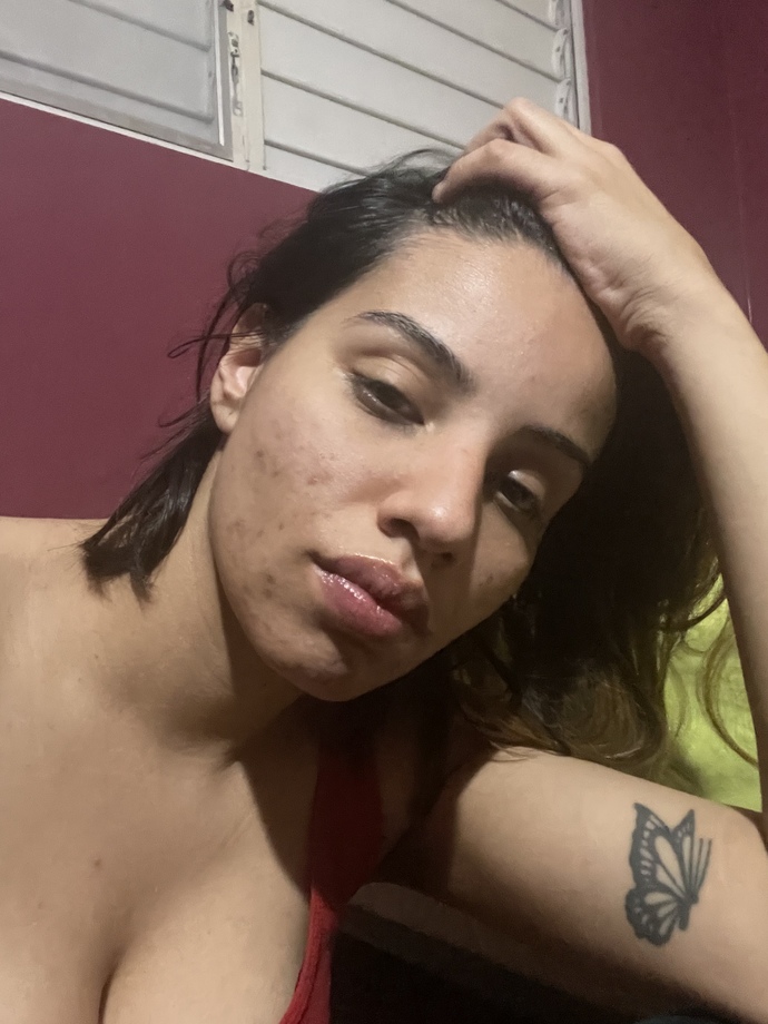 When will acne stop? Why does every product I use makes my skin worse?