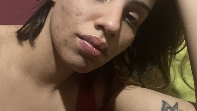 When will acne stop? Why does every product I use makes my skin worse?