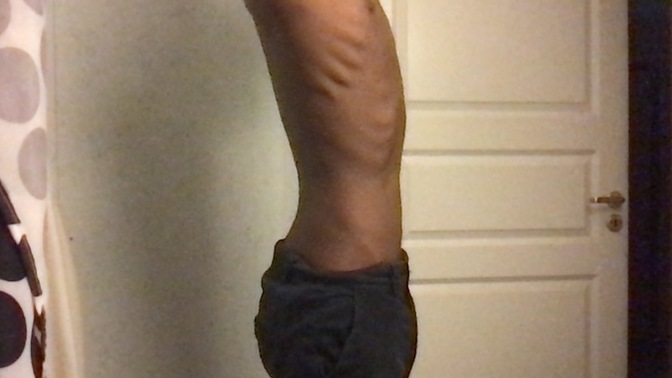How do I gain weight? 26 year old, 5"6 ,99 pounds?