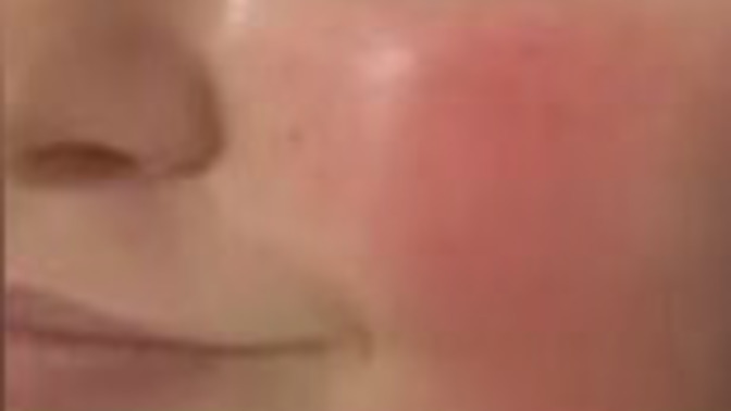 Natural Red Cheeks?