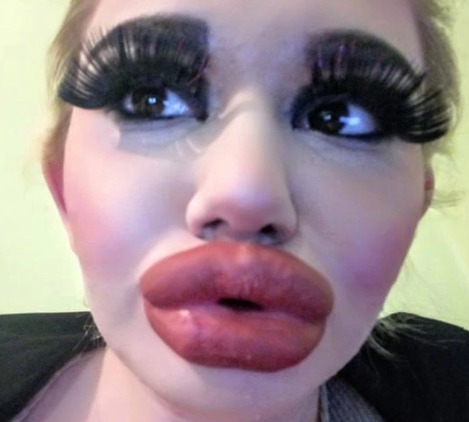 Them lips
